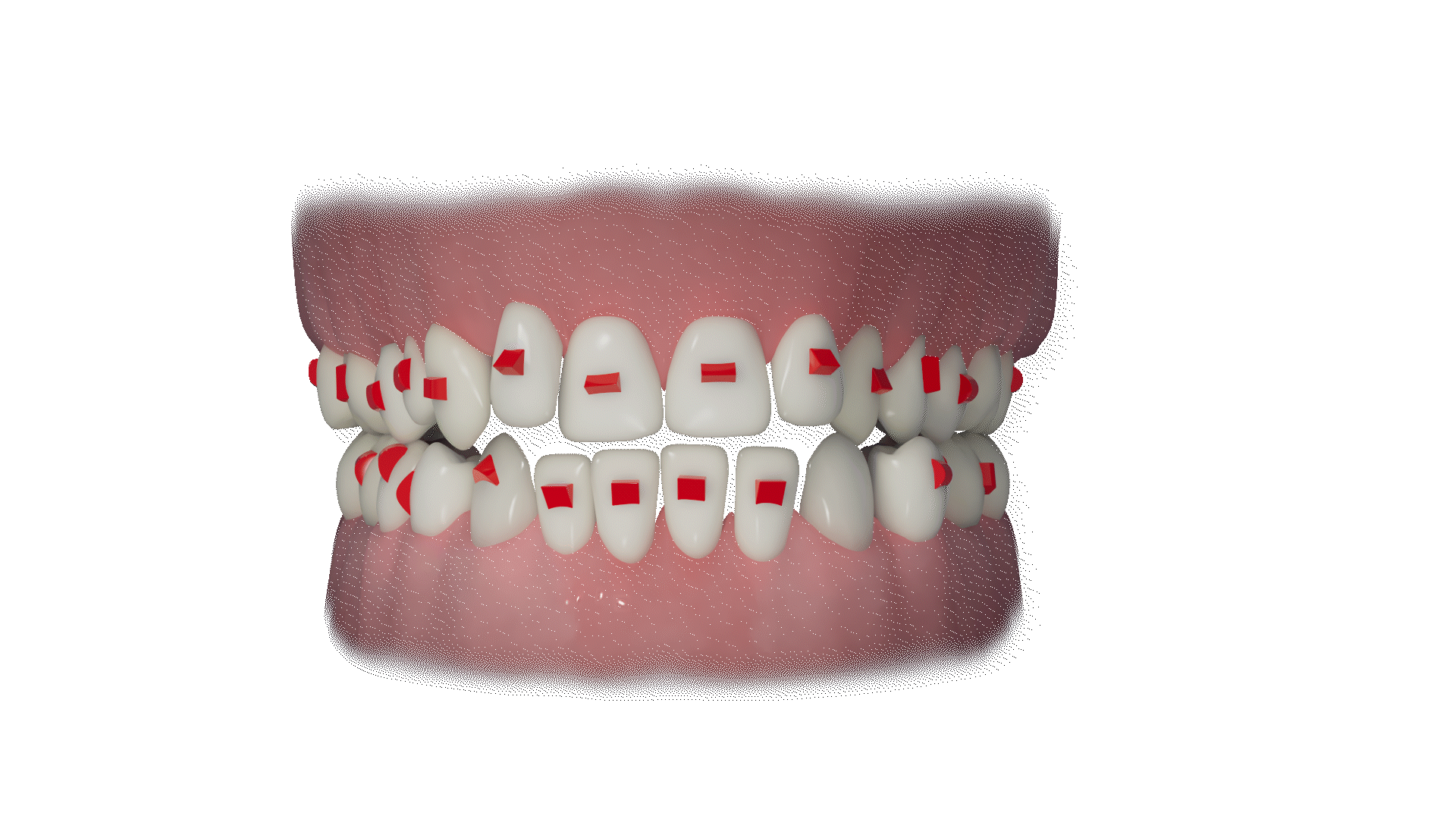 A_2_Ausgangsversion-schiefe_Zaehne_zeigen_zeigen29_Alpha