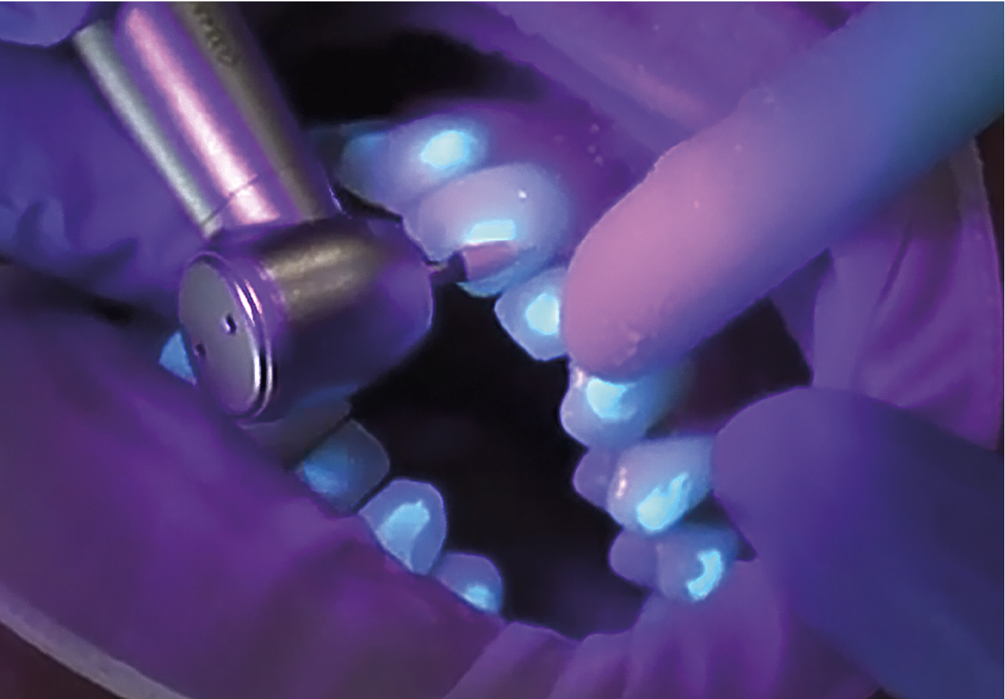 Fluorescent Removal icon