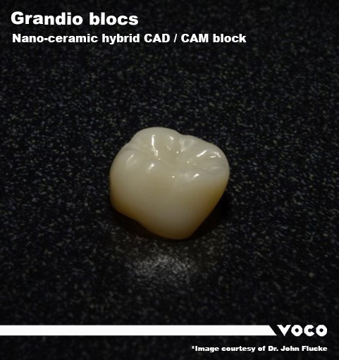 Nano-ceramic hybrid CAD/CAM dental crown example labeled “Grandio blocs” displayed on a dark textured surface.