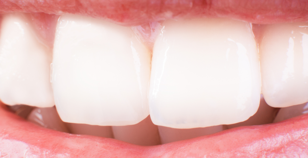 closeup on teeth icon